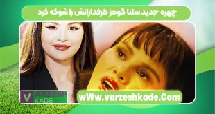 چهره جدید سلنا گومز طرفدارانش را شوکه کرد