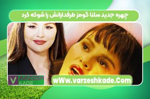 چهره جدید سلنا گومز طرفدارانش را شوکه کرد